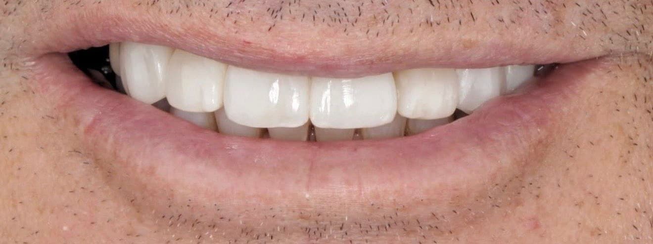 Clinical case 1 by Dr. Jaqueline Amadeu Merino — After