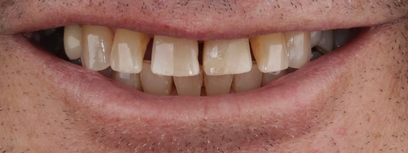Clinical case 1 by Dr. Jaqueline Amadeu Merino — Before