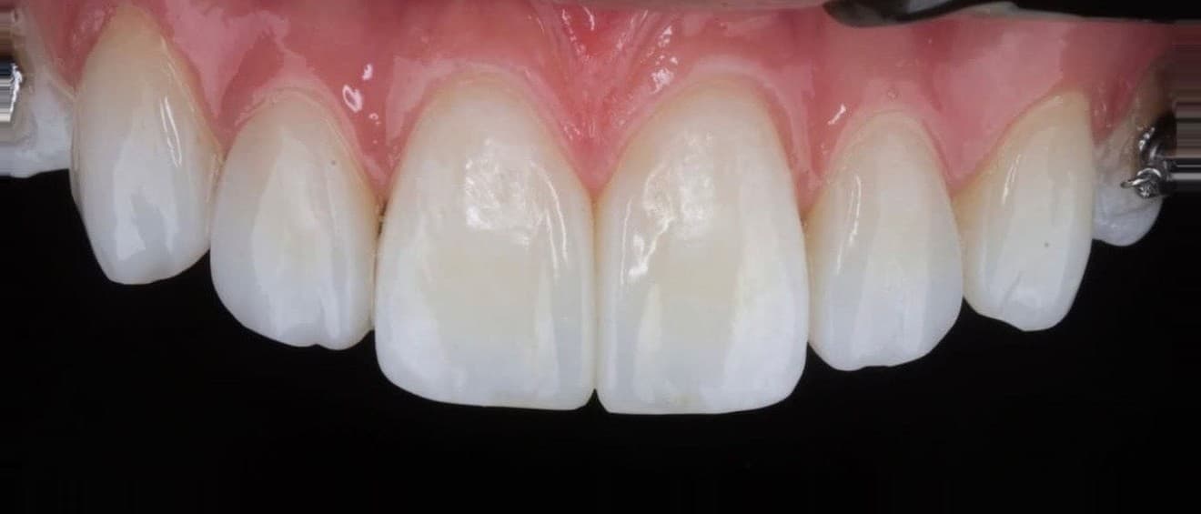 Clinical case 2 by Dr. Jaqueline Amadeu Merino — After