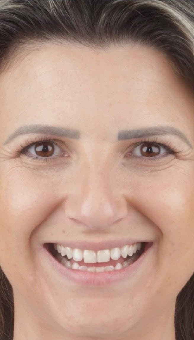 Clinical case 3 by Dr. Jaqueline Amadeu Merino — Before